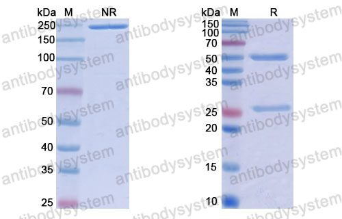 Валидация SDS-PAGE - AntibodySystem RHJ92809