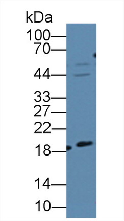 12659