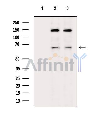 Валидация Affinity DF10171 - 5707