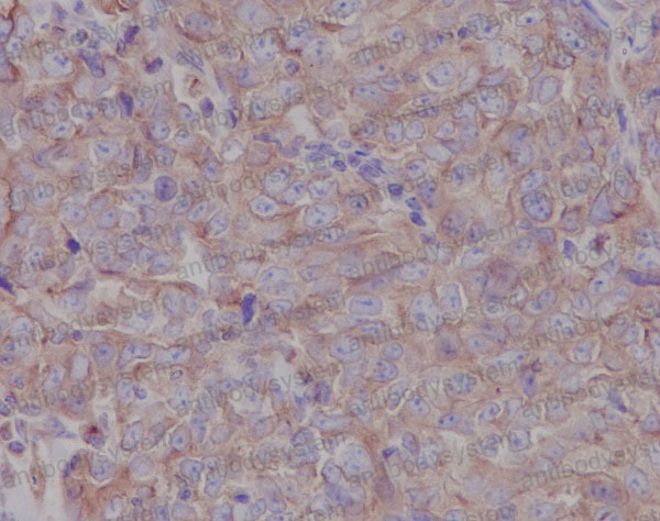 Валидация AntibodySystem RHD77701