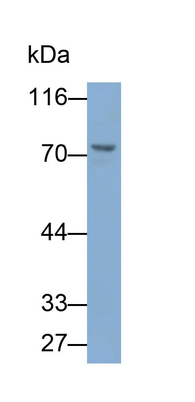 31661
