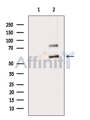 Валидация Affinity DF4560 - 16152