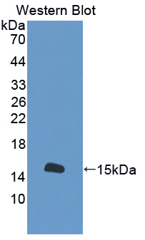 56157