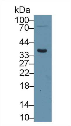 14638