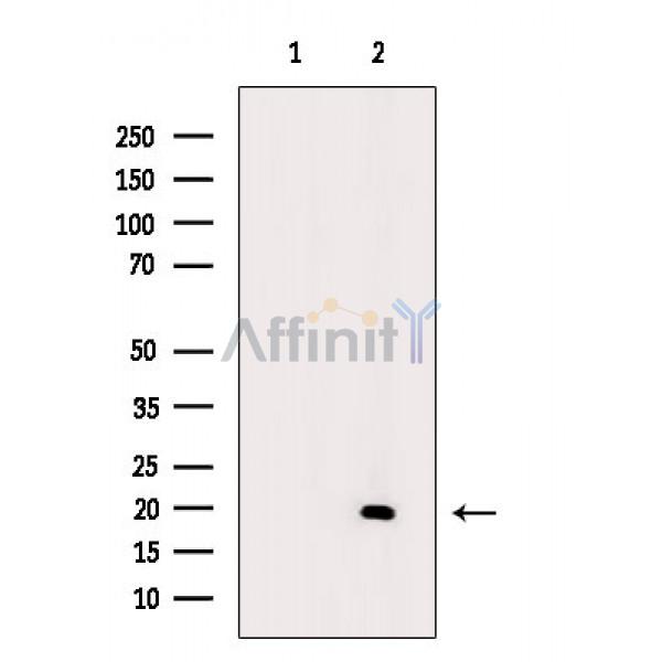 Валидация Affinity AF6869 - 4085