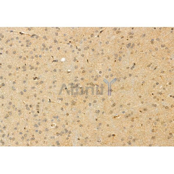 Валидация Affinity DF12083 - 6174