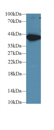 374