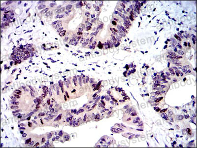 Валидация AntibodySystem RHA51404