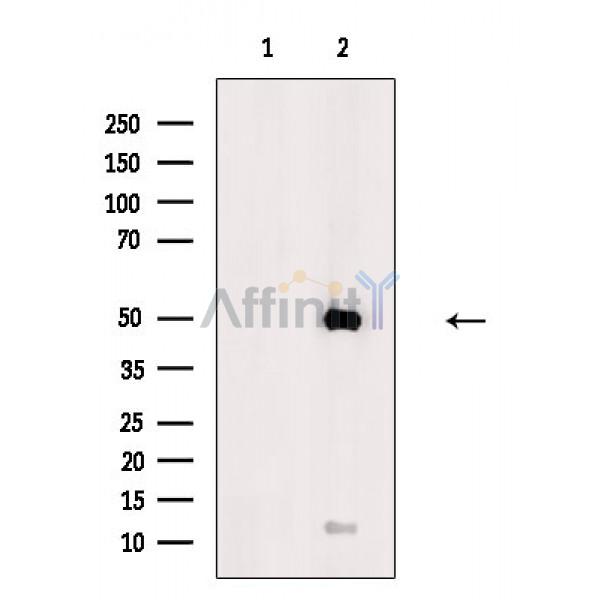 Валидация Affinity DF3576 - 14530