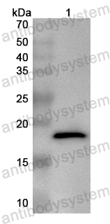 Валидация AntibodySystem PHB65301