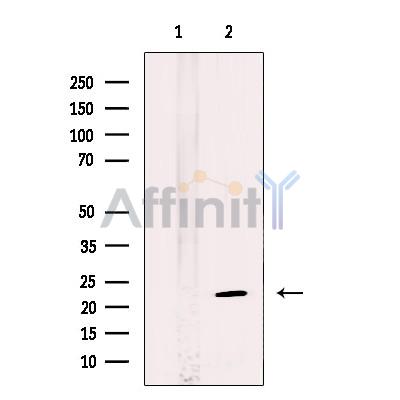 Валидация Affinity DF12276 - 6620