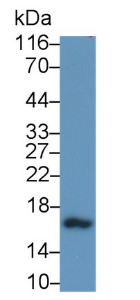 55671