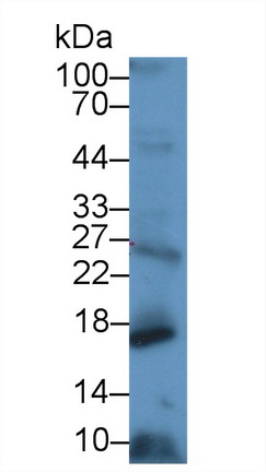 14767