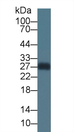 14858