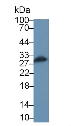 9500
