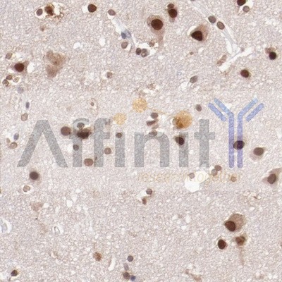 Валидация Affinity AF6261 - 3512