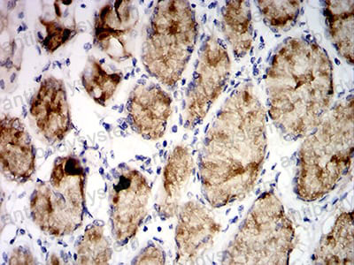 Валидация AntibodySystem RHF78603