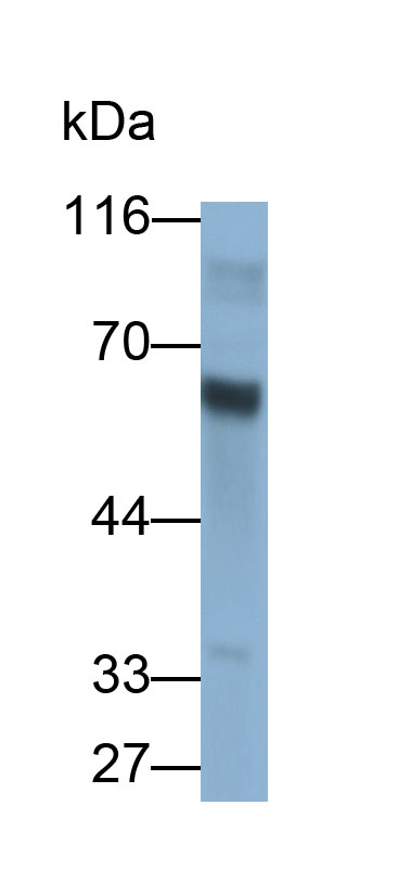 32555