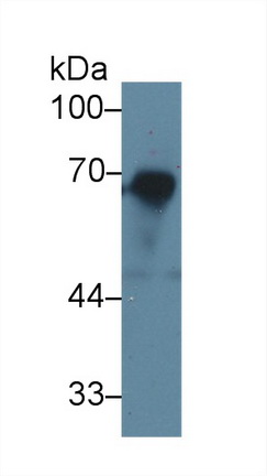 13587