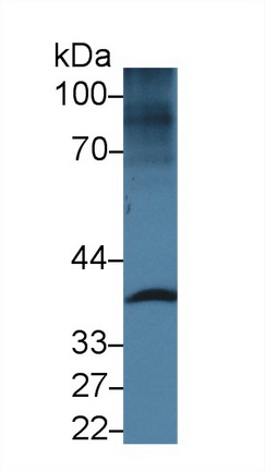 13970