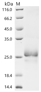 SDS-PAGE