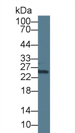 12755