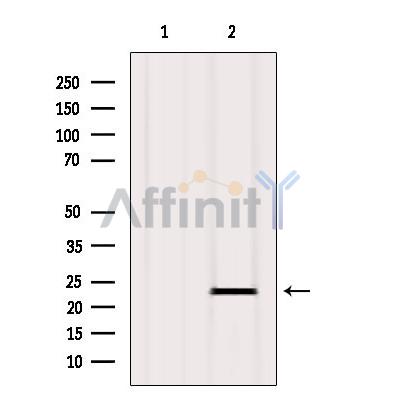 Валидация Affinity AF6386 - 3683