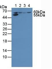 5747