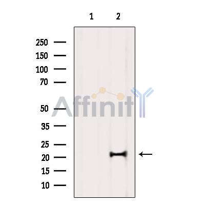 Валидация Affinity DF9616 - 22330