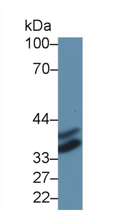 14144
