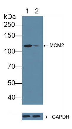 12148