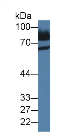 14317