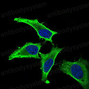 Валидация IF - AntibodySystem RHF91202