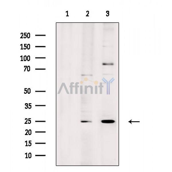 Валидация Affinity DF3737 - 14798