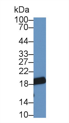 62652