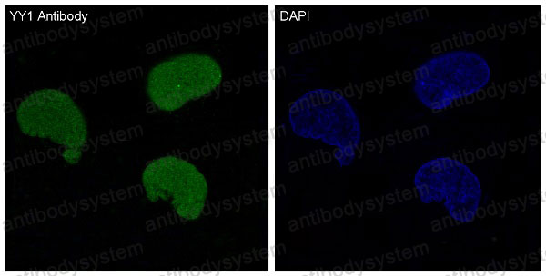 Валидация IF - AntibodySystem RHD67301
