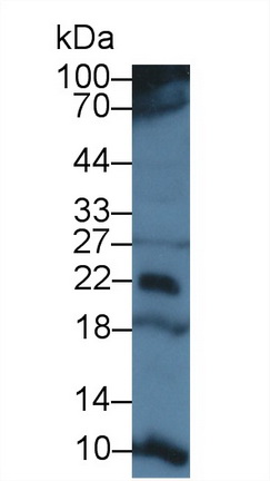 14742