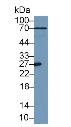 10315