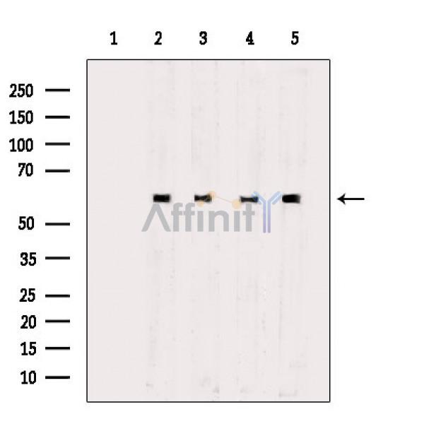 Валидация Affinity AF3923 - 2066