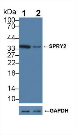 12257