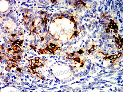 Валидация AntibodySystem RHC82901 (1094)