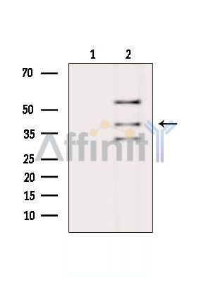 Валидация Affinity DF15033 - 11246