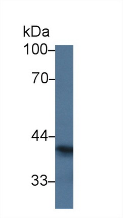 9542