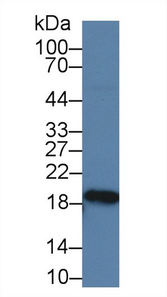 14223