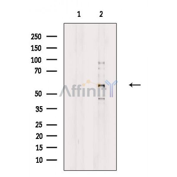 Валидация Affinity DF8645 - 20599