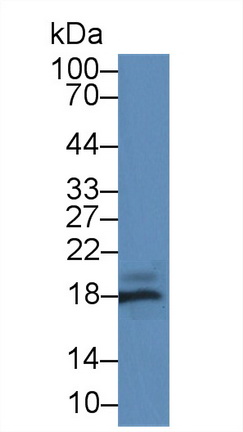 14777
