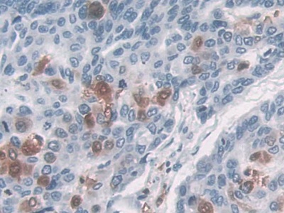17942