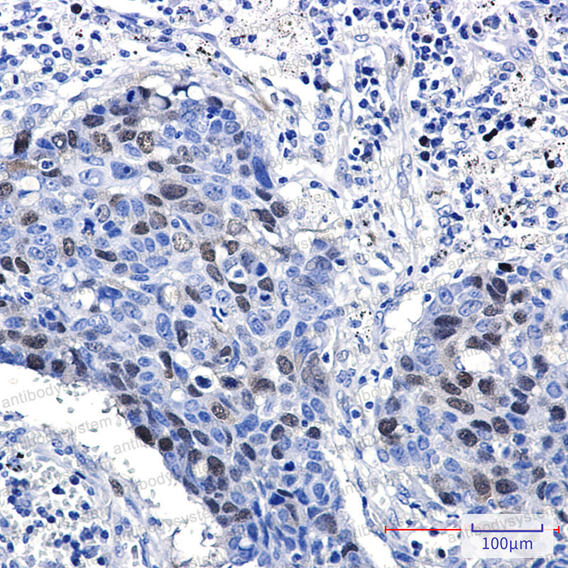 Валидация AntibodySystem RHD38204