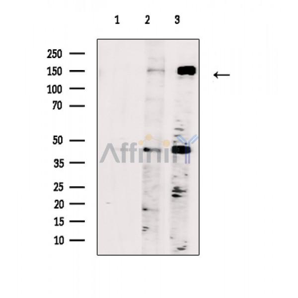 Валидация Affinity DF2578 - 13255