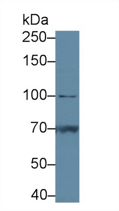 13561